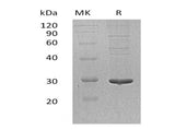 Recombinant Human PDIA5 Protein (His Tag)