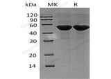 Recombinant Human PDIA6 Protein (His Tag)