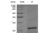 Recombinant Human FAM19A4 Protein (His Tag)