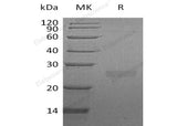 Recombinant Human FAM3D Protein (His Tag)