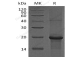 Recombinant Human PKC epsilon/PKCE Protein (His Tag)