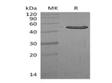 Recombinant Human WDYHV1/NTAQ1 Protein (GST Tag)