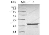 Recombinant Human PPP1R14A Protein (His Tag)