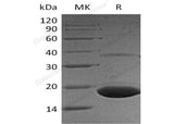 Recombinant Human PPP1R1A Protein (His Tag)