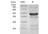 Recombinant Human PPP1CC Protein (His Tag)