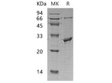 Recombinant Human PPM1G/PP2C-gamma Protein (His Tag)