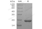 Recombinant Human SCO1/SCOD1 Protein (GST Tag)