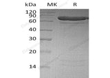 Recombinant Human PADI4 Protein (His Tag)