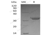 Recombinant Human Proteinase 3/PRTN3 Protein (His Tag)