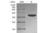 Recombinant Human PTPN6/SH-PTP1 Protein (His Tag)