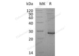 Recombinant Human Proteoglycan 3/PRG3 Protein (His Tag)