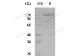 Recombinant Human Protocadherin-1/PCDH1 Protein (His Tag)