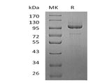 Recombinant Human Protocadherin-10/PCDH10 Protein (His Tag)