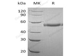 Recombinant Human PRV1/CD177 Protein (His Tag)