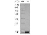 Recombinant Human PCBD1 Protein (His Tag)