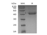 Recombinant Human SFTPD/SP-D Protein (Glu22Gly, His Tag)