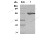 Recombinant Human PKLR Protein (His Tag)