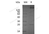 Recombinant Human RANKL/TNFSF11 Protein (His Tag)(Active)