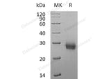 Recombinant Human RANK/TNFRSF11A Protein (His Tag) 