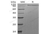 Recombinant Human HER2/ErbB2 Protein (His Tag)