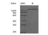 Recombinant Human HER2/ErbB2 Protein (Fc Tag)