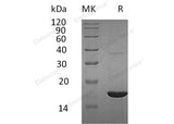 Recombinant Human REG3G/PAP-1B Protein (His Tag)