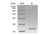 Recombinant Human REG4/RELP Protein (His Tag)