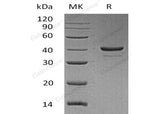 Recombinant Human Resistin Protein (aa 19-108, Fc Tag)