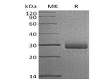 Recombinant Human Retbindin/RTBDN Protein (His Tag)