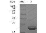 Recombinant Human RARRES2/TIG2 Protein (His Tag)