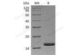 Recombinant Human Retinol-Binding Protein 2/RBP2 Protein