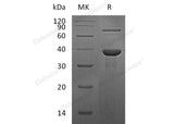 Recombinant Human RBP3 Protein (His Tag)