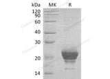 Recombinant Human Ribonuclease K6/RNASE6 Protein (His Tag)