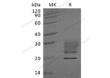 Recombinant Human Ribonuclease A/RNASE1 Protein (His Tag)