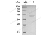 Recombinant Human PRPS2 Protein (His Tag)