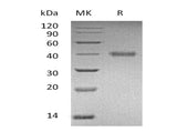 Recombinant Human R-Spondin 1/RSPO1 Protein (His Tag)(Active)