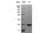 Recombinant Human S100A8 Protein (His Tag)