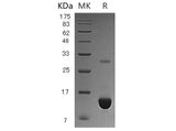 Recombinant Human S100P/S100E Protein (His Tag)