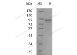 Recombinant Human Secretogranin-2/SCG2 Protein (His Tag)