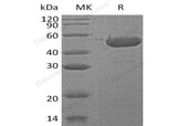 Recombinant Human Sedoheptulokinase/SHPK Protein (His Tag)