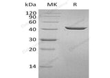 Recombinant Human SEPHS1 Protein (His Tag)