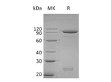 Recombinant Human Semaphorin 3C/SEMA3C Protein (His Tag)