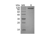 Recombinant Human Semaphorin 4G/SEMA4G Protein (His Tag)