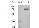 Recombinant Human SEMA4B Protein (His Tag)