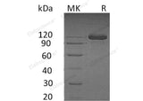 Recombinant Human SEMA4B Protein (His & Fc Tag)