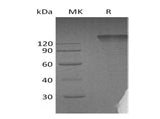 Recombinant Human Semaphorin 4D/SEMA4D Protein (Fc Tag)(Active)