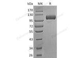 Recombinant Human Semaphorin 5A/SEMA5A Protein (aa 23-765, His Tag)