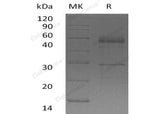 Recombinant Human Semenogelin-1/SEMG1 Protein (His Tag)