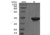 Recombinant Human SENP2 Protein (His Tag, SUMO Tag)