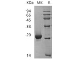 Recombinant Human SENP7 Protein (His Tag)